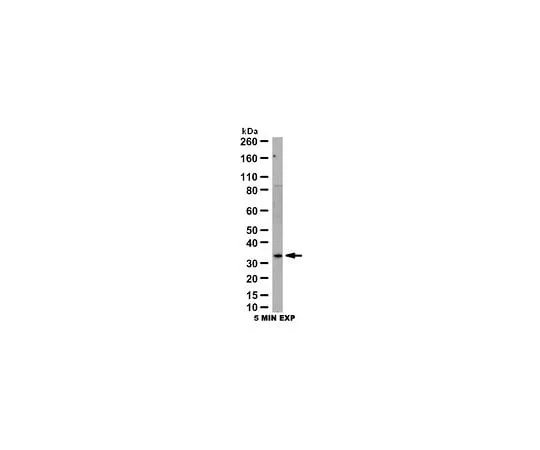 62-8454-61 Anti-Galectin-3; 100 μL AB10541