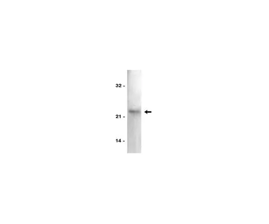 62-8370-78 Anti-p21/WAF1/Cip1; 200 μg 05-345