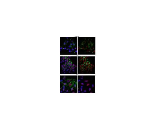 62-8383-29 Anti-mRNA-capping enzyme; 100 μL 06-1354