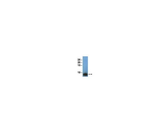 62-8385-92 Anti-Surfactant Protein B; 50 μL 07-614