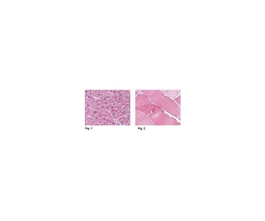 62-8458-84 Anti-ARC ABC837