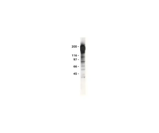62-8372-87 Anti-Phosphotyrosine, recombinant clone 4G10R; 1 mg 05-777
