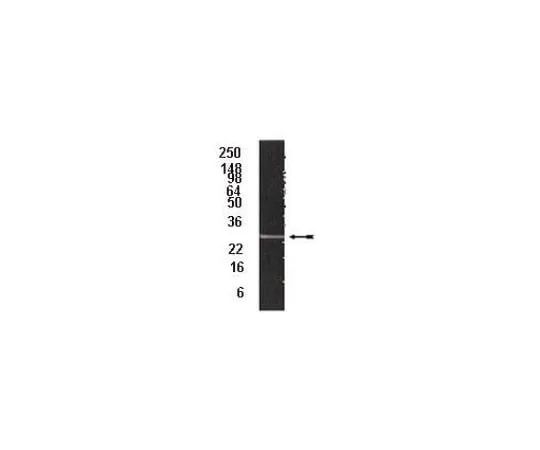 62-8367-87 Anti-20S proteasome subunit α2, clone MCP21; 100 μL 04-039