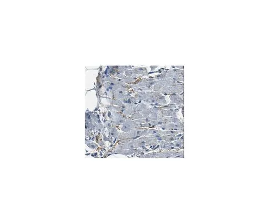 62-8456-64 Anti-ANGPTL2 ABC85