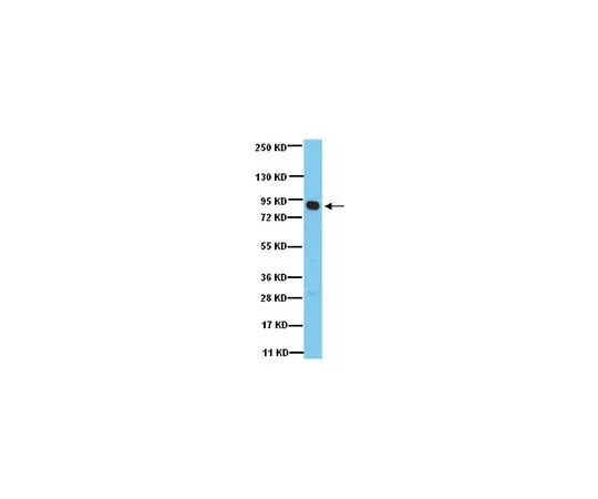 62-8387-78 Anti-Rsk1; 100 μg 07-1477