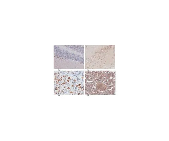 62-8466-01 Anti-TFG; 100 μg ABN180
