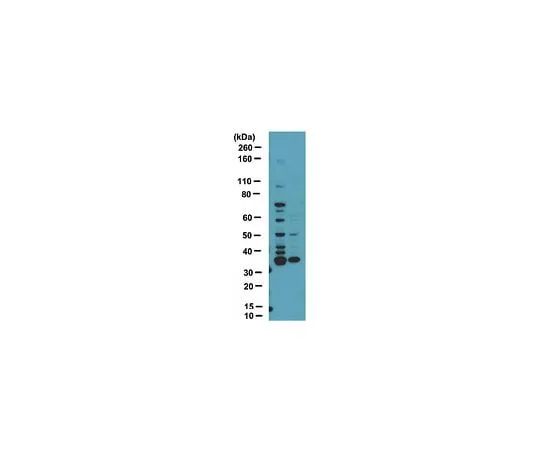 62-8389-96 Anti-dimethyl-Arginine, asymmetric (ASYM25); 100 μL 09-814