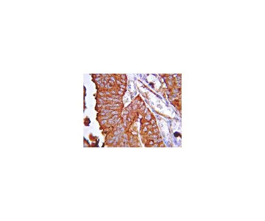 62-8382-99 Anti-Sonic Hedgehog; 100 μL 06-1106