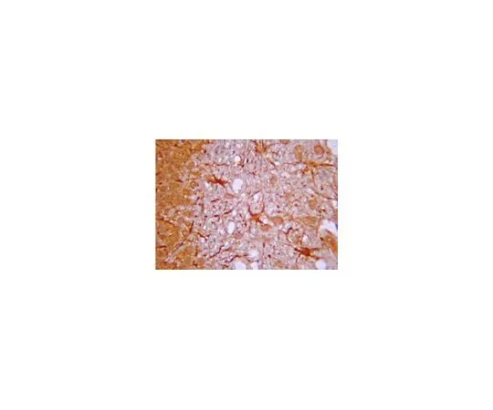 62-8387-17 Anti-IP3 Receptor; 100 μg 07-1210