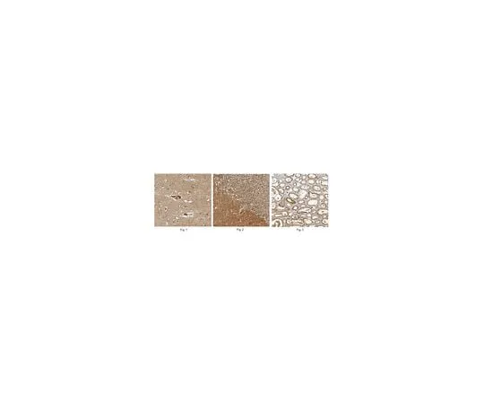 62-8467-05 Anti-TRAPPC1 ABN415