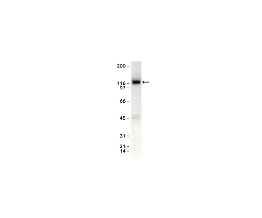 62-8371-31 Anti-Eck/EphA2, clone D7; 200 μg 05-480