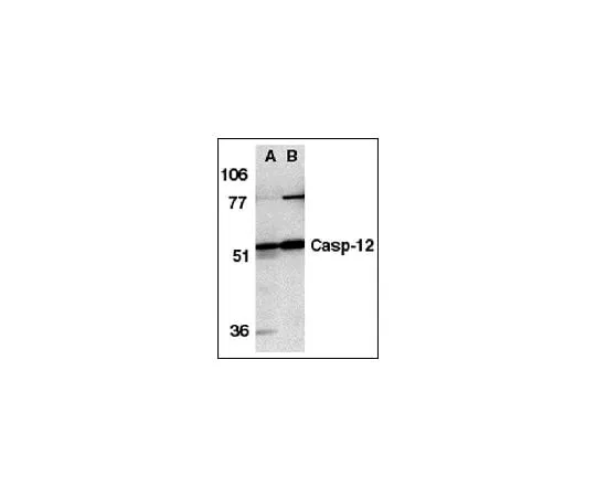 62-8448-28 Anti-Caspase 12, N-terminus; 100 μg AB3613