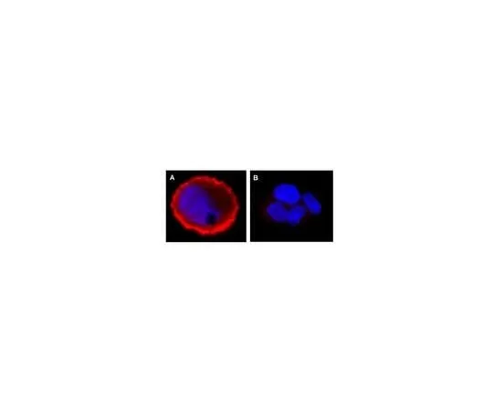 62-8381-18 Anti-phospho-erbB-2/HER-2 (Tyr1248); 100 μL 06-229