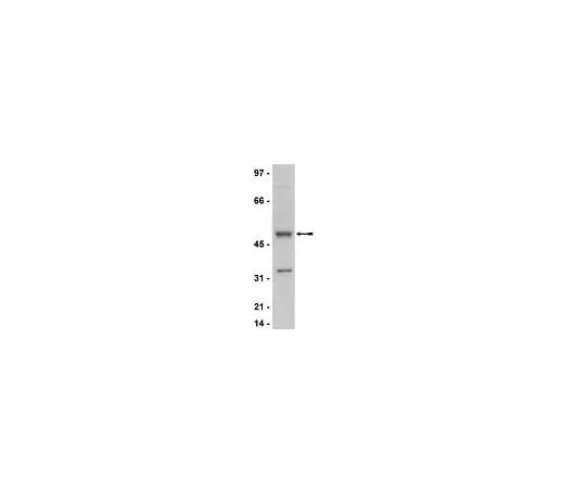 62-8386-23 Anti-Cyclin E; 100 μg 07-687