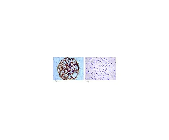 62-8374-25 Anti-Insulin, clone MAB1; 1 mg 05-1108
