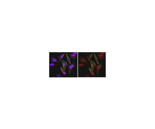 62-8459-65 Anti-FOXC1; 100 μg ABD71