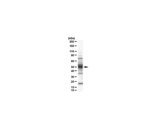 62-8462-13 Anti-ALKBH5 ABE547