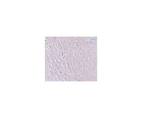 62-8467-49 Anti-SYNPO ABN481