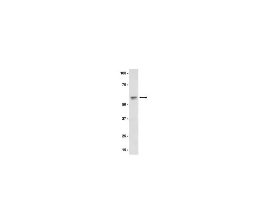 62-8384-94 Anti-Akt1/PKBα; 100 μg 07-416