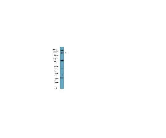 62-8388-39 Anti-FIP200; 100 μL 07-1815