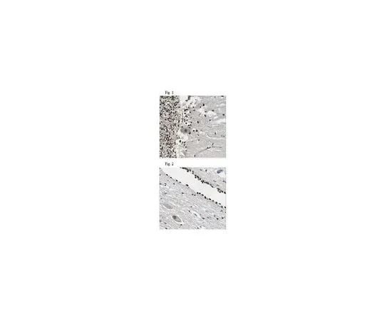 62-8457-14 Anti-GLI1 Antibody Cat. No. ABC217 ABC217