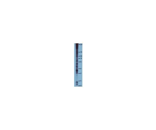 62-8392-86 Anti-Phosphoserine, clone 4A4, HRP Conjugate; 10 blots 16-455
