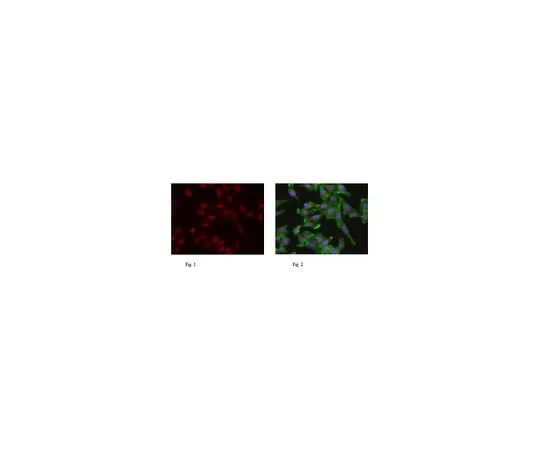 62-8461-63 Anti-TIF1-alpha ABE434