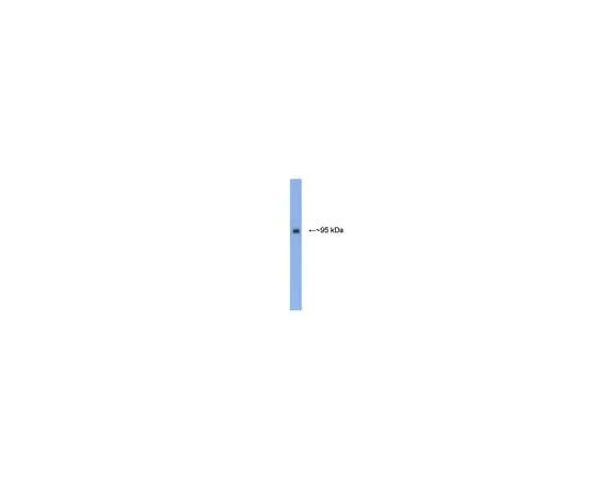 62-8453-46 Anti-PSD-95; 100 μg AB9708