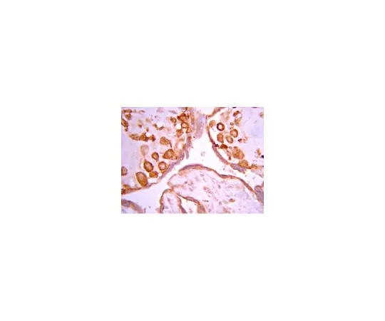 62-8387-30 Anti-phospho-MARCKS (Ser152/156); 100 μL 07-1238