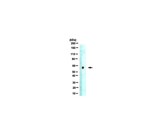 62-8461-58 Anti-Jarid2 ABE425