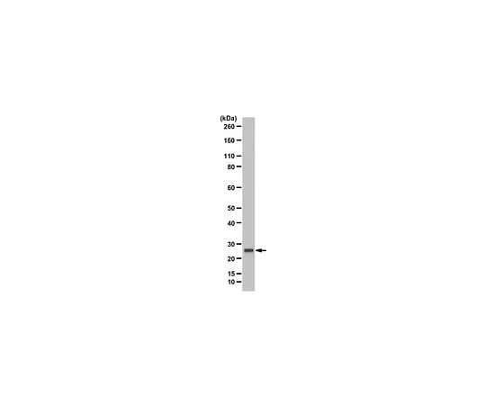 62-8468-03 Anti-CCM3/PDCD10 ABN1016