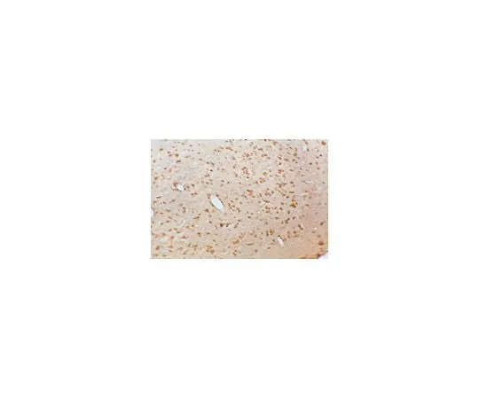 62-8445-73 Anti-Brain Derived Neurotrophic Factor; 500 μg AB1779SP