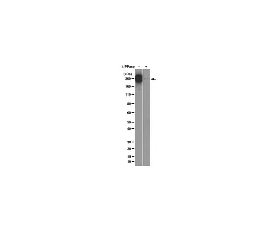 62-8369-48 Anti-RNA polymerase II subunit B1 (phospho CTD Ser-2), clone 3E10; 100 μg 04-1571