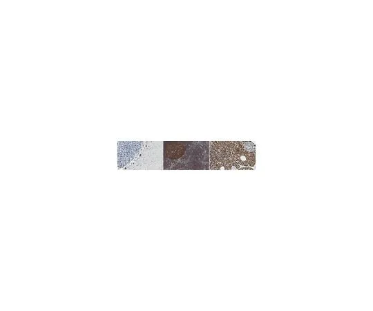 62-8463-83 Anti-La-Related Protein 1 ABE1800