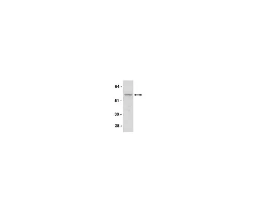 62-8372-91 Anti-Akt3/PKBγ, clone GMA104; 100 μg 05-780