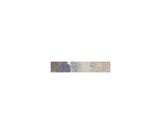 62-8464-42 Anti-TGF-beta Receptor Antibody, type I ABF17-I
