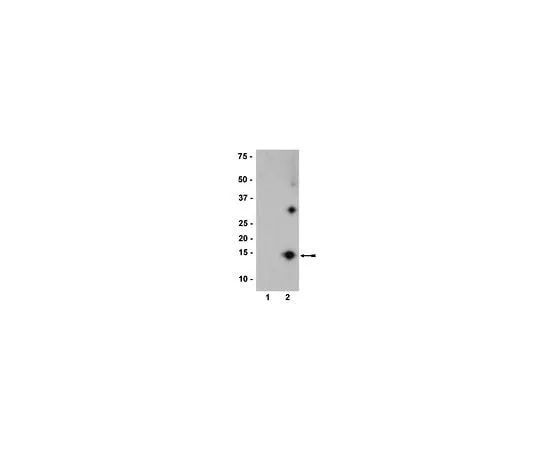 62-8396-18 Anti-nitro-α/β-Synuclein, clone nSyn12; 200 μL 36-011