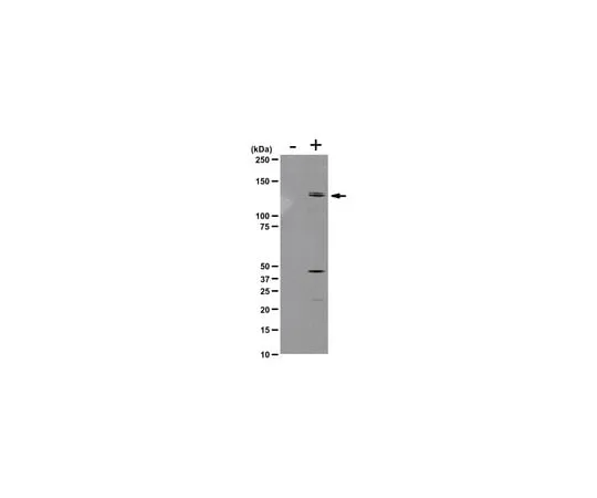 62-8368-52 Anti-phospho-MYPT1 (Thr850), clone SA19 ; 100 μl 04-773
