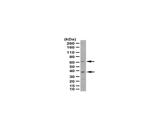 62-8466-30 Anti-PANK2 Antibody Cat. No. ABN259 ABN259