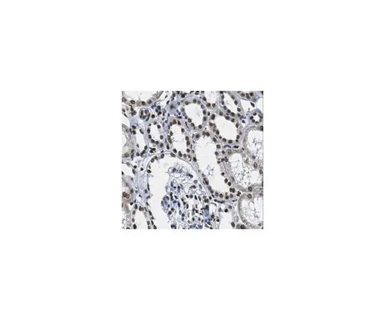 62-8463-14 Anti-Polyhomeotic-like protein 2 (PHC2) ABE1069