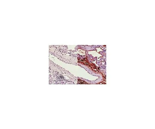 62-8381-26 Anti-Nitrotyrosine; 100 μg 06-284
