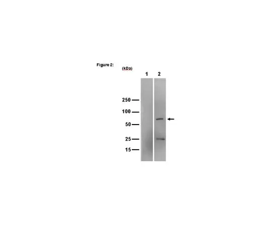 62-8367-58 RIPAb+(TM) IGF2 mRNA-binding protein 3; 10 assays 03-198