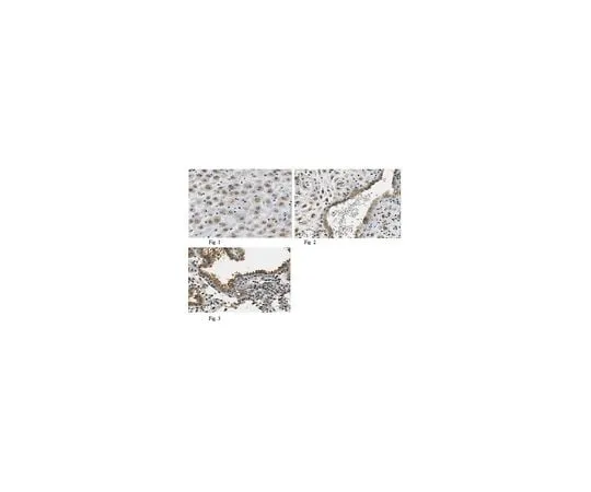 62-8464-70 Anti-Bst2 ABF200