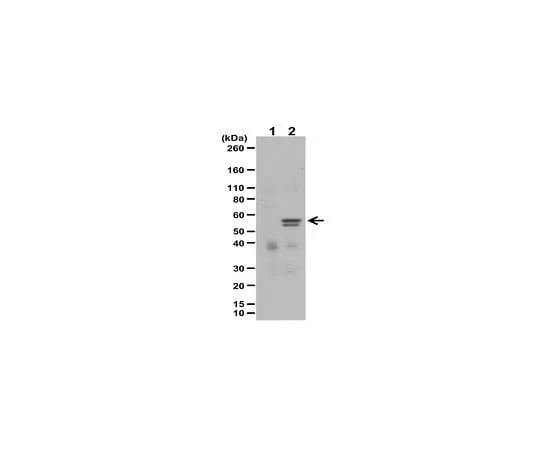 62-8394-89 Anti-phospho-MLKL (Ser358) Antibody Set 17-10400