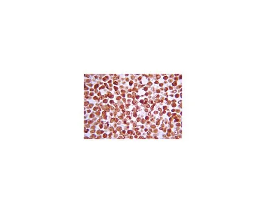 62-8387-79 Anti-IKKβ; 100 μg 07-1479