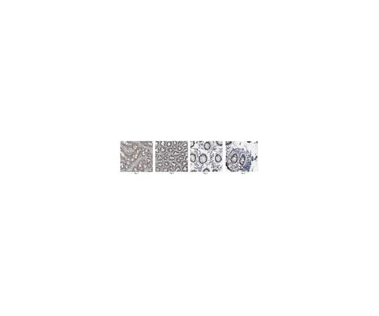 62-8461-66 Anti-Apobec1 ABE438