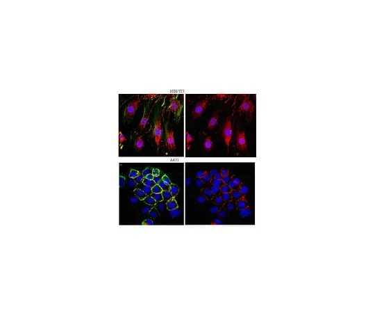 62-8460-64 Anti-β-Catenin; 100 μg ABE208