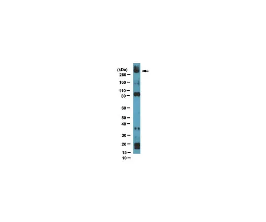 62-8369-44 Anti-NSD1, clone 1NW-1A10; 100 μL 04-1565
