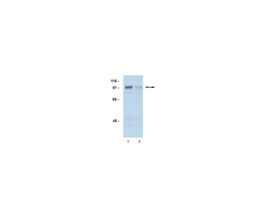 62-8367-94 Anti-phospho-Androgen Receptor (Ser81); 100 μL 04-078