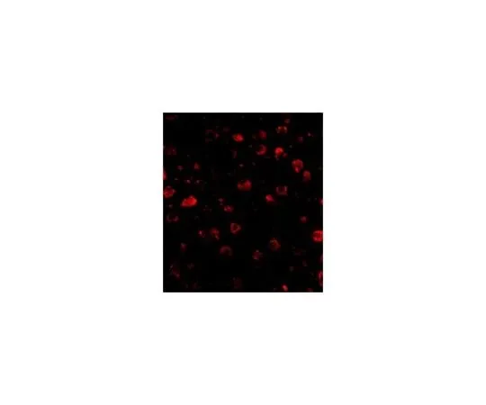 62-8462-41 Anti-SATB1 ABE602